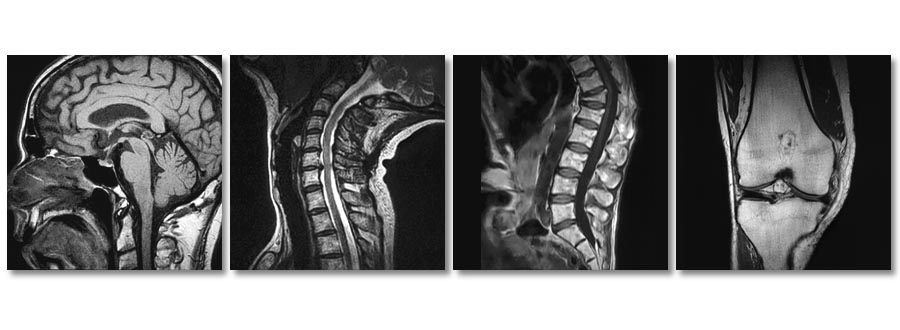 StandUp MRI of Staten Island